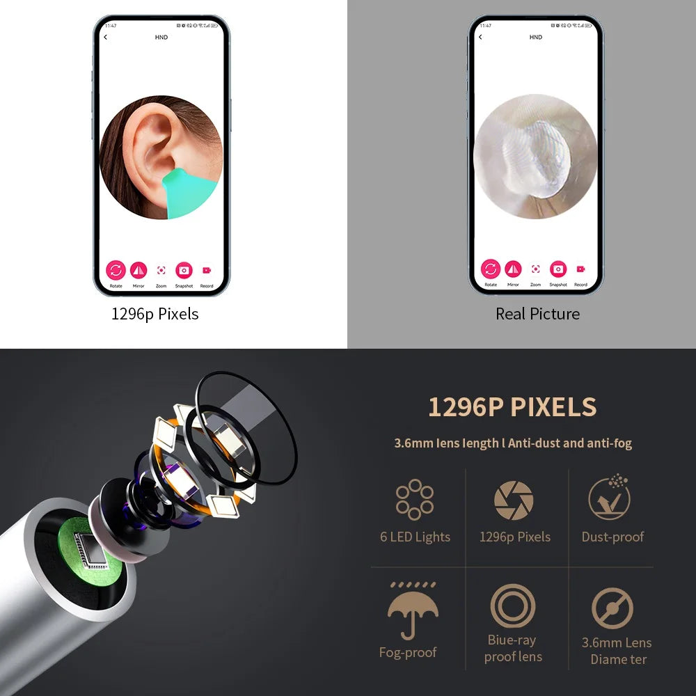 WiFi Ear Cleaner Camera - 6 LED Lights 3.6mm HD Video Otoscope