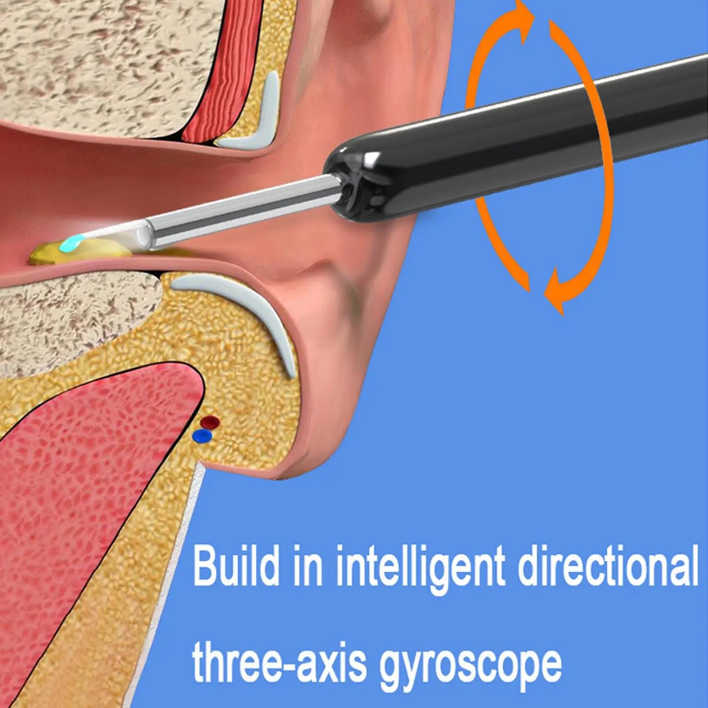 Nettoyeur d'oreilles intelligent et visuel avec caméra et lumière LED, outil sans fil pour éliminer le cérumen, otoscope de haute précision, nettoyage sûr et indolore, facile