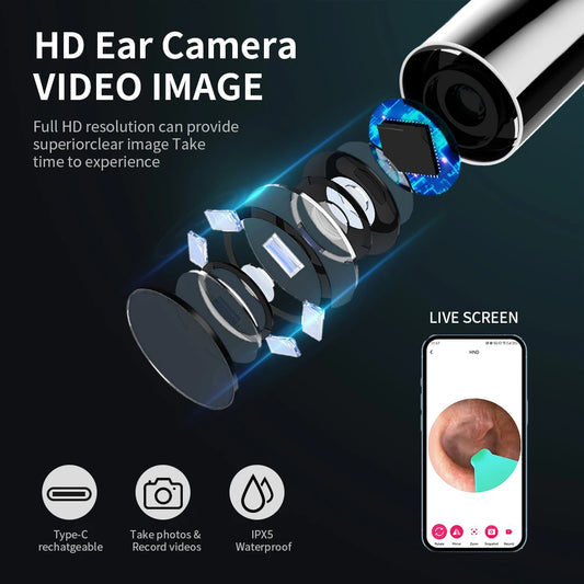 WiFi Ear Cleaner Camera - 6 LED Lights 3.6mm HD Video Otoscope