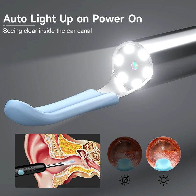 Nettoyeur d'oreilles avec caméra 4,2 mm, WiFi, outil de retrait de cérumen, prise de photos HD 1080p, cure-oreille visuel, cuillère d'oreille, étanche, 6 LED, chargement USB C